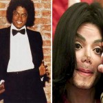 Operatii estetice esuate