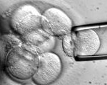 Cum sa-ti cresti propriul transplant...din testicule